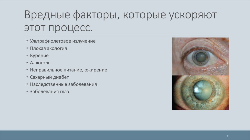Заболеваниями заболеваний глаз появиться. Врожденные заболевания глаз. Наследственные заболевания глаз. Наиболее распространенные заболевания глаз. Презентация заболевания глаз.