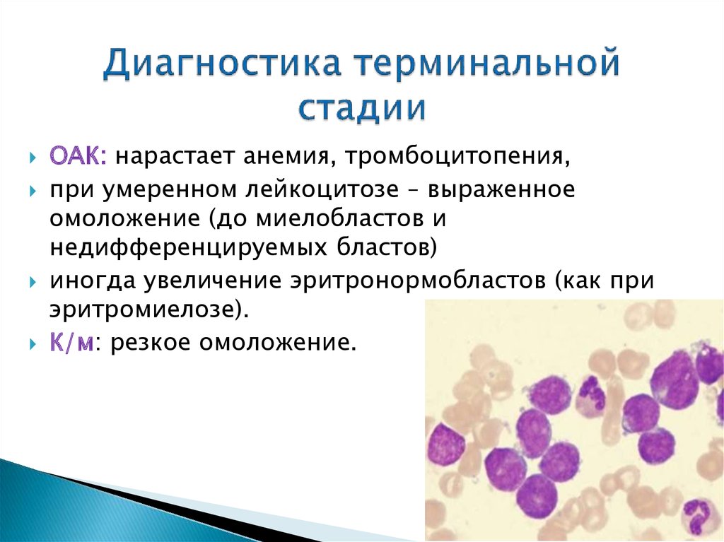 Диагноз лейкоцитоз. Лейкоцитоз анемия тромбоцитопения. Тромбоцитопения ОАК. ОАК : анемия + лейкоцитоз. Умеренный лейкоцитоз.