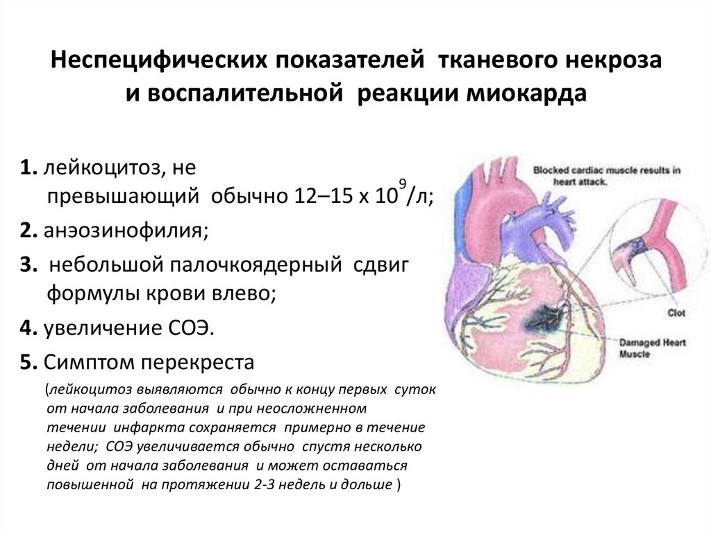 Изменения миокарда левого желудочка сердца. Что такое неспецифические изменения St-t в сердце. Неспецифические изменения миокарда. Диффузные неспецифические изменения миокарда. Умеренные неспецифические изменения миокарда желудочков.