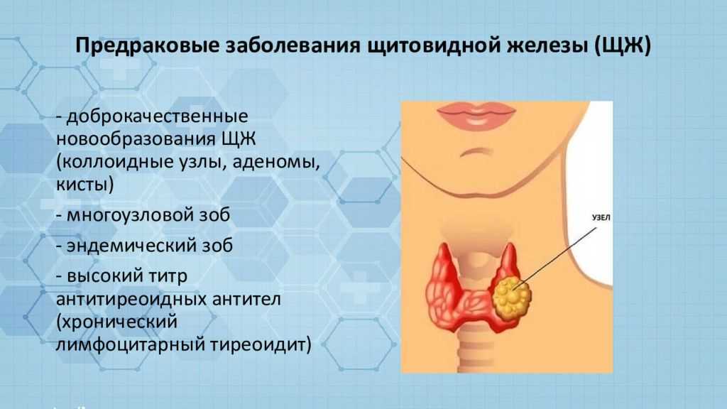 Что значит щитовидная железа