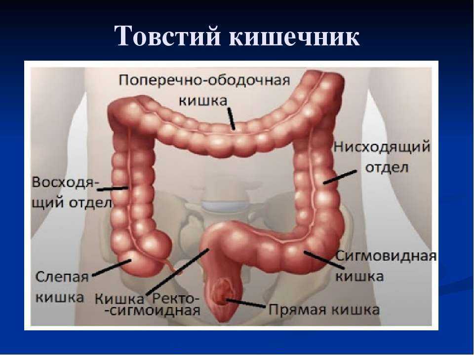 Дивертикулез кишечника мкб 10