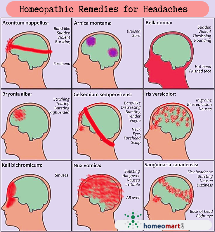 Виды головной боли. Зоны головной боли. Типы головной боли схема. Головная боль локализация.