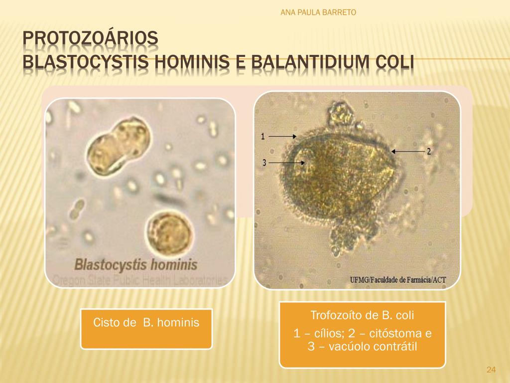 Простейшие в кале лечение. Цисты blastocistis Hominis. Бластоцисты в Кале под микроскопом. Бластоцисты простейшие.