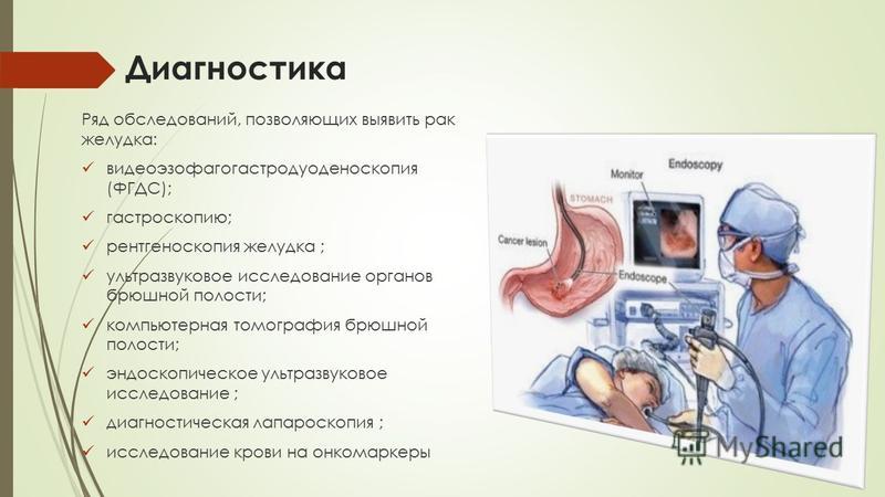 Тесты по эндоскопии. Гастроскопия (ЭГДС, ФГДС). Эндоскопические методы исследования желудка. УЗИ органов брюшной полости ФГДС.