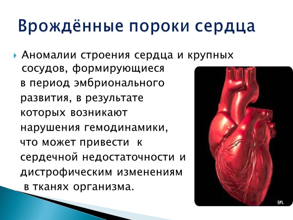 Порог сердца что это. Врожденные пороки сердца анатомия. ВРАЖДЕНЫЙ порог сердца. Врожденныепопроки сердца. Врожденный порог Серда.