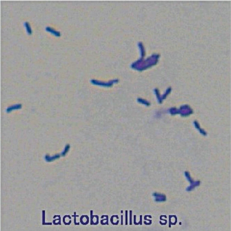 Лактобациллы SSP. Лактобациллы в мазке. Лактобациллы 10 в 4.