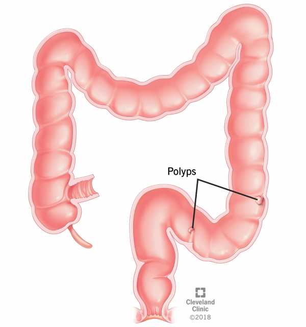 Сигма кишечника. Анатомия толстой кишки и прямой кишки. Строение кишечника и прямой кишки. Толстый кишечник в разрезе.
